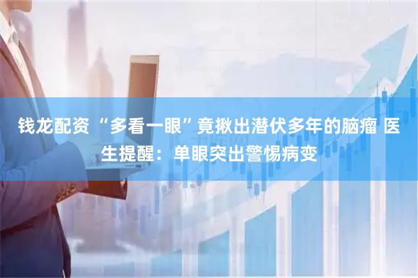 钱龙配资 “多看一眼”竟揪出潜伏多年的脑瘤 医生提醒：单眼突出警惕病变